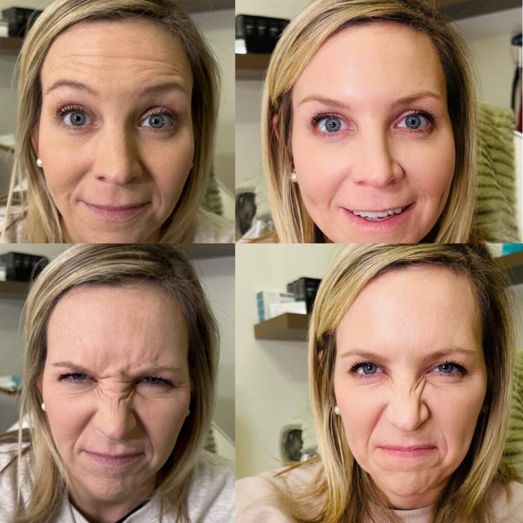 Before and After Image: Neurotoxin - front